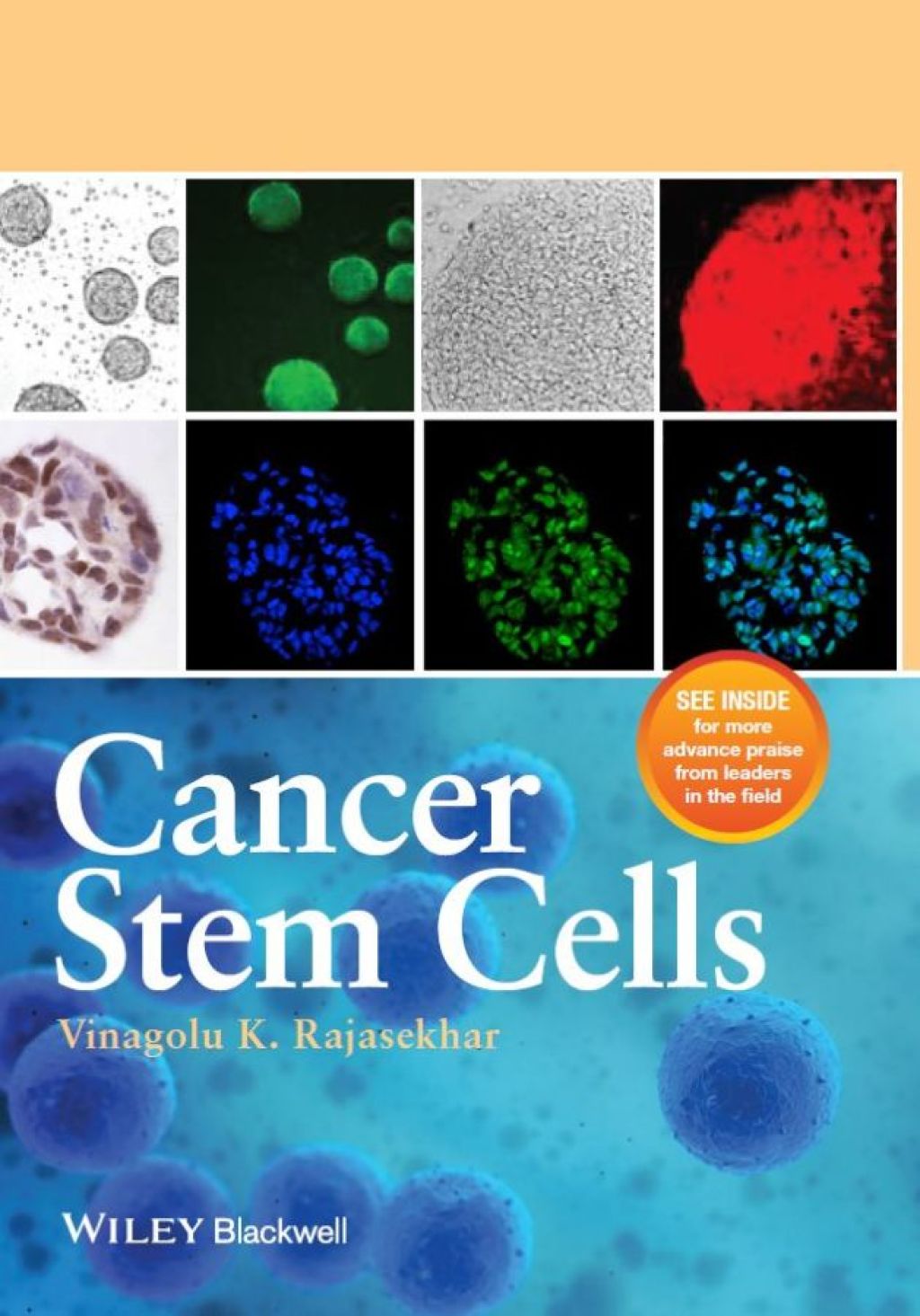 Cancer Stem Cells 1st Edition
