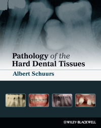 صورة الغلاف: Pathology of the Hard Dental Tissues 1st edition 9781405153652
