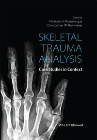 Imagen de portada: Skeletal Trauma Analysis: Case Studies in Context 1st edition 9781118384220
