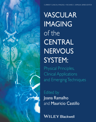 Imagen de portada: Vascular Imaging of the Central Nervous System 1st edition 9781118188750