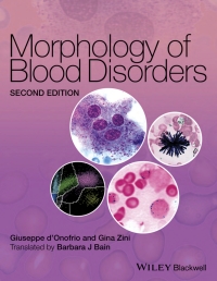 صورة الغلاف: Morphology of Blood Disorders 2nd edition 9781118442609