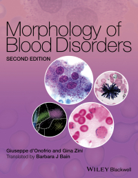 Imagen de portada: Morphology of Blood Disorders 2nd edition 9781118442609
