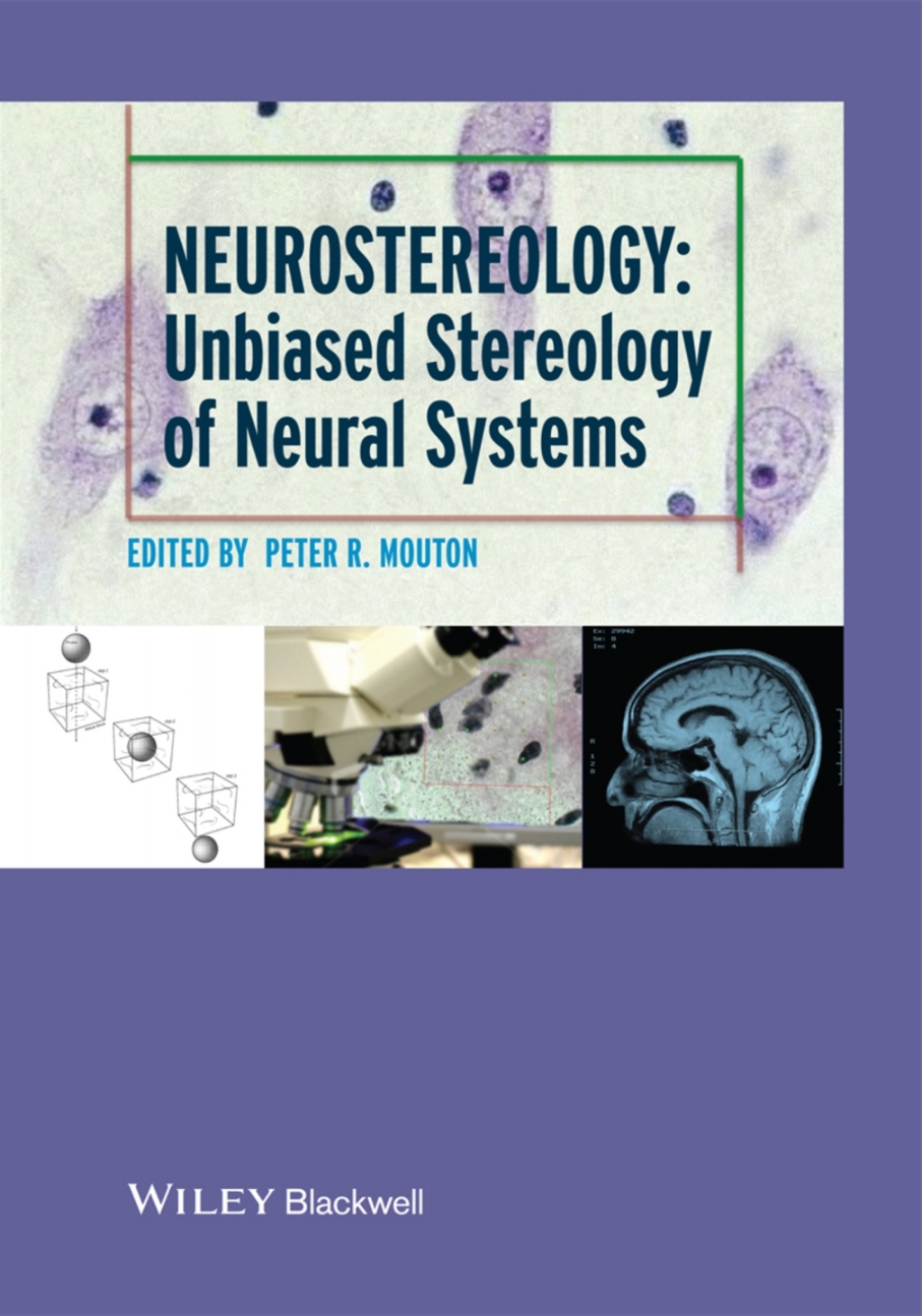 Neurostereology Unbiased Stereology of Neural Systems 1st Edition