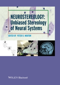 Cover image: Neurostereology 1st edition 9781118444214