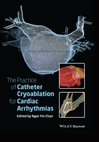 Imagen de portada: The Practice of Catheter Cryoablation for Cardiac Arrhythmias 1st edition 9781118451830