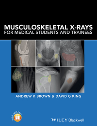 Omslagafbeelding: Musculoskeletal X-Rays for Medical Students and Trainees 1st edition 9781118458730