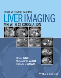Cover image: Liver Imaging: MRI with CT Correlation 1st edition 9780470906255
