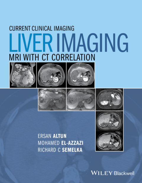 Liver Imaging: MRI with CT Correlation: MRI with CT Correlation, 1st Edition - FULL INSTANT DOWNLOAD | PDF DOCX EPUB