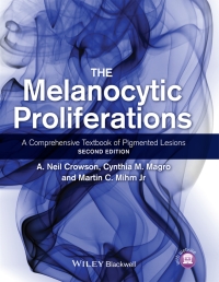 Cover image: The Melanocytic Proliferations 2nd edition 9780470561553