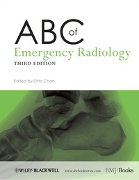 صورة الغلاف: ABC of Emergency Radiology 3rd edition 9780470670934