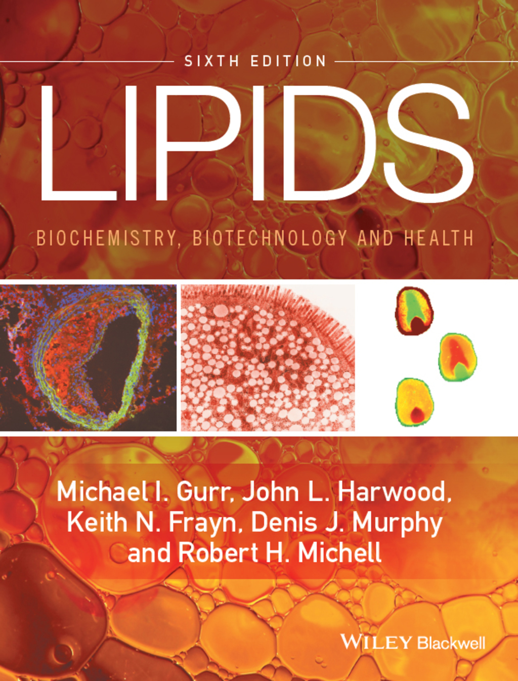 Lipids: Biochemistry, Biotechnology and Health 6th Edition