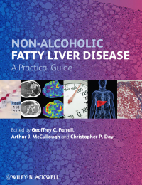 Imagen de portada: Non-Alcoholic Fatty Liver Disease 1st edition 9780470673171