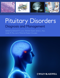 صورة الغلاف: Pituitary Disorders 1st edition 9780470672013