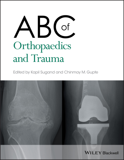 ABC of Orthopaedics and Trauma, 1st Edition - FULL INSTANT DOWNLOAD | PDF DOCX EPUB