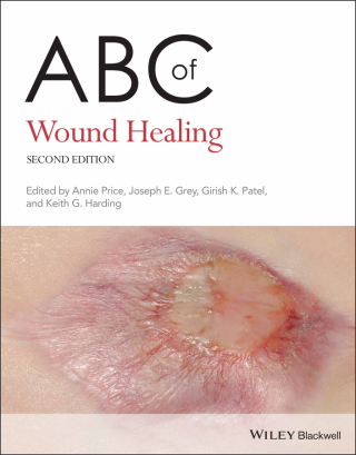 Cover image: ABC of Wound Healing 2nd edition 9780470658970