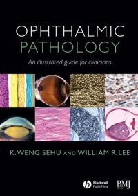 صورة الغلاف: Ophthalmic Pathology: An Illustrated Guide for Clinicians 1st edition 9780727917799