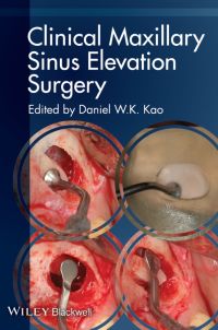 Cover image: Clinical Maxillary Sinus Elevation Surgery 1st edition 9780470960738