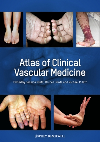 Cover image: Atlas of Clinical Vascular Medicine 1st edition 9780470658093