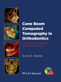 Cover image: Cone Beam Computed Tomography in Orthodontics 1st edition 9781118448489