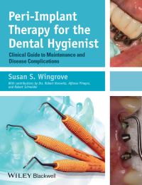 Cover image: Peri-Implant Therapy for the Dental Hygienist 1st edition 9780470962855