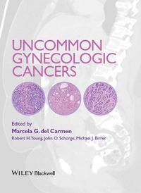 Omslagafbeelding: Uncommon Gynecologic Cancers 1st edition 9781118655351