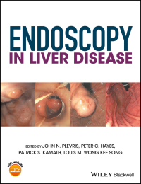 Cover image: Endoscopy in Liver Disease 1st edition 9781118660874
