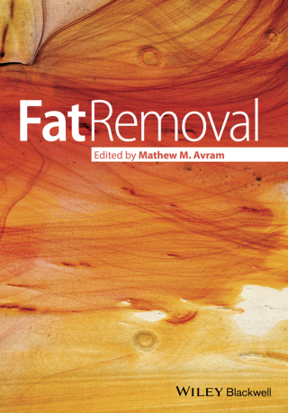 Imagen de portada: Fat Removal 1st edition 9781444334289