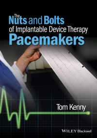 Cover image: The Nuts and Bolts of Implantable Device Therapy 1st edition 9781118670675