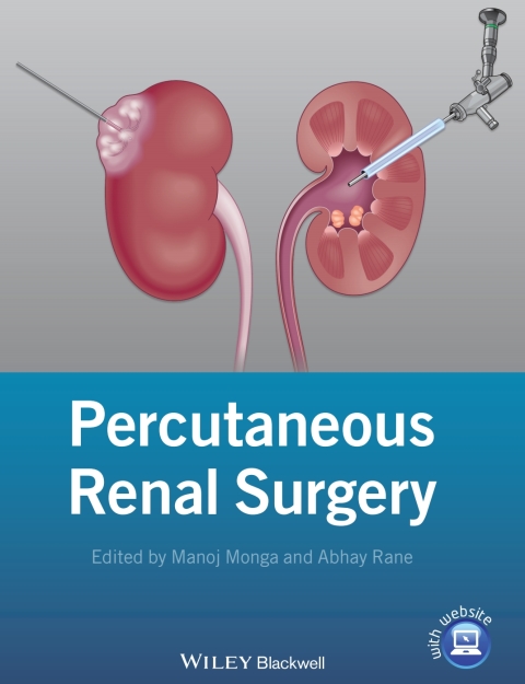 Percutaneous Renal Surgery, 1st Edition - FULL INSTANT DOWNLOAD | PDF DOCX EPUB