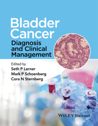 Cover image: Bladder Cancer: Diagnosis and Clinical Management 1st edition 9781118674840