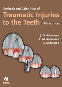 Cover image: Textbook and Color Atlas of Traumatic Injuries to the Teeth 4th edition 9781405129541