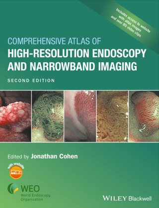 Cover image: Comprehensive Atlas of High-Resolution Endoscopy and Narrowband Imaging 2nd edition 9781118705933