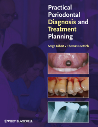 Cover image: Practical Periodontal Diagnosis and Treatment Planning 1st edition 9780813811840