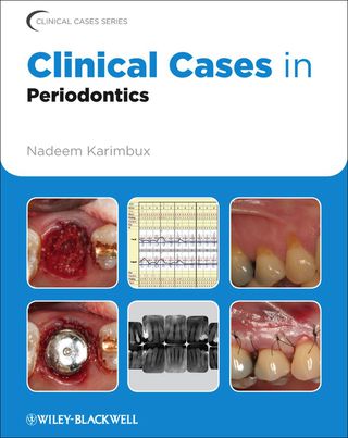 Immagine di copertina: Clinical Cases in Periodontics 1st edition 9780813807942