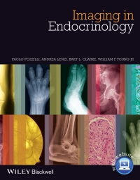 Imagen de portada: Imaging in Endocrinology 1st edition 9780470656273