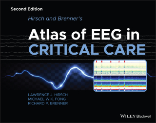 Cover image: Hirsch and Brenner's Atlas of EEG in Critical Care 2nd edition 9781118752890