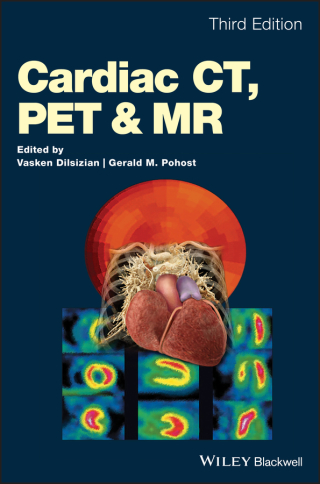 Imagen de portada: Cardiac CT, PET and MR 3rd edition 9781118754504