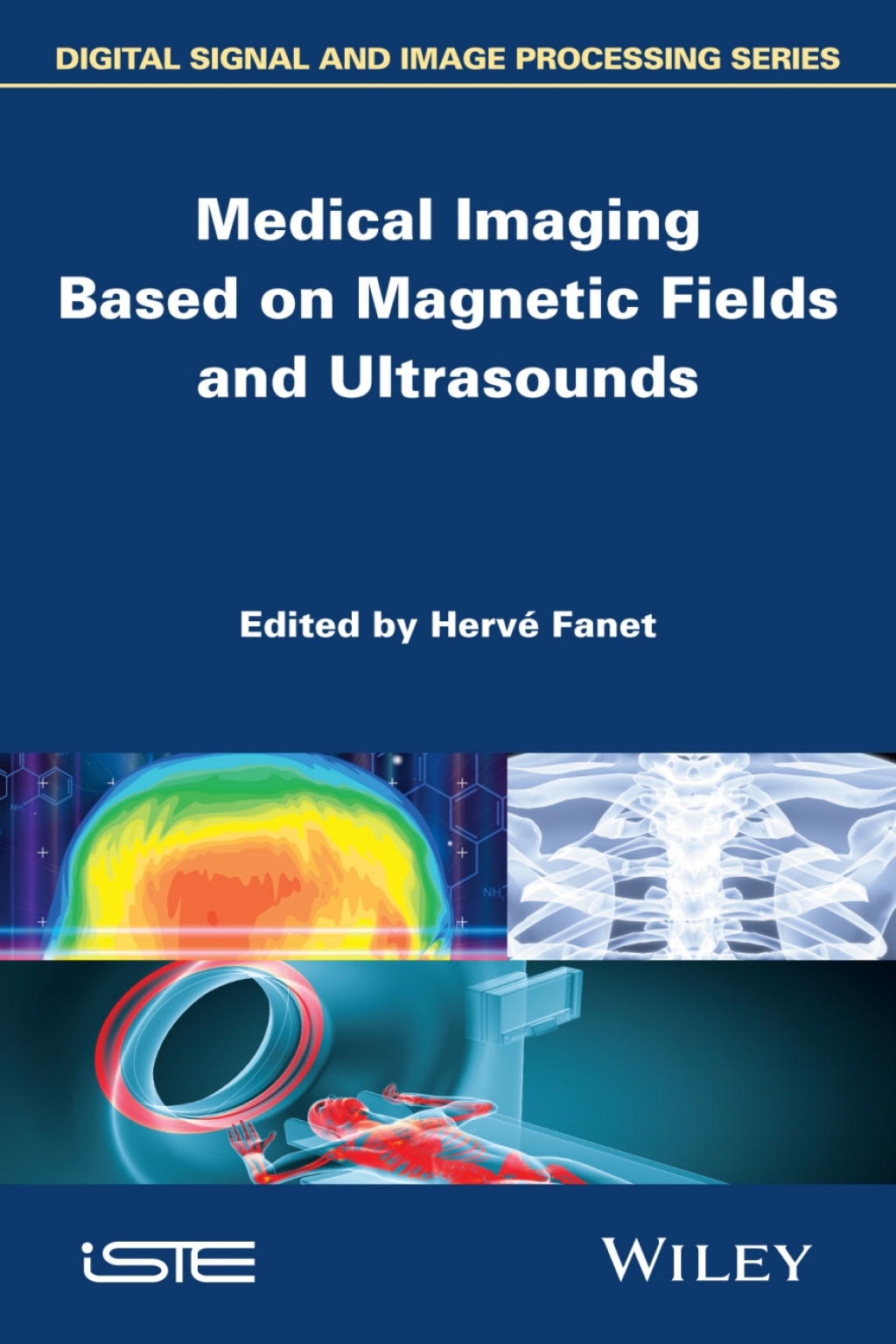 Medical Imaging Based on Magnetic Fields and Ultrasounds 1st Edition