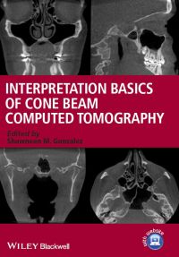 Cover image: Interpretation Basics of Cone Beam Computed Tomography 1st edition 9781118381069