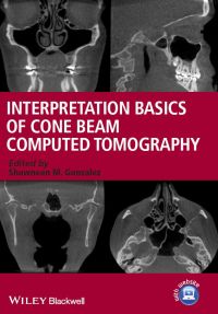 صورة الغلاف: Interpretation Basics of Cone Beam Computed Tomography 1st edition 9781118381069