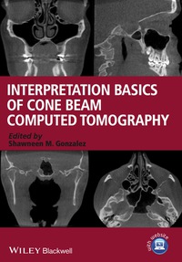 Titelbild: Interpretation Basics of Cone Beam Computed Tomography 1st edition 9781118381069
