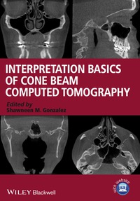 Cover image: Interpretation Basics of Cone Beam Computed Tomography 1st edition 9781118381069