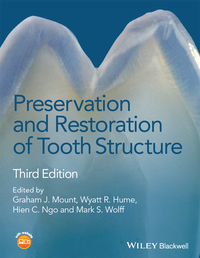 Cover image: Preservation and Restoration of Tooth Structure 3rd edition 9781118766590