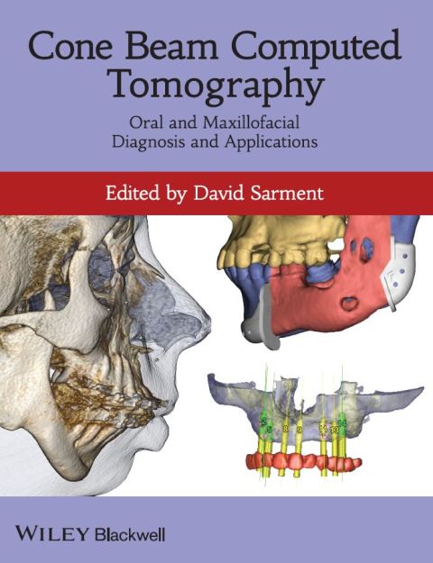 Cone Beam Computed Tomography: Oral and Maxillofacial Diagnosis and Applications, 1st Edition - FULL INSTANT DOWNLOAD | PDF DOCX EPUB
