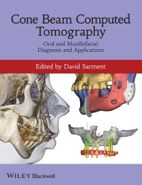 Cover image: Cone Beam Computed Tomography 1st edition 9780470961407