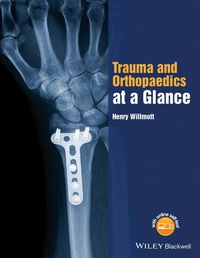 Cover image: Trauma and Orthopaedics at a Glance 1st edition 9781118802533