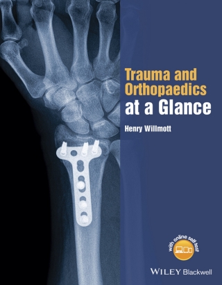 表紙画像: Trauma and Orthopaedics at a Glance 1st edition 9781118802533