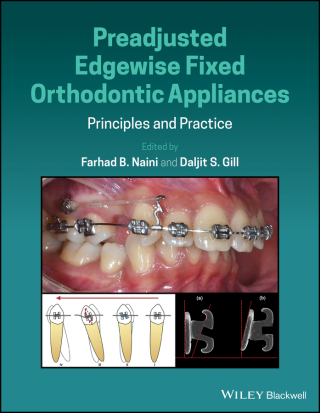 Cover image: Preadjusted Edgewise Fixed Orthodontic Appliances 1st edition 9781118817698