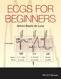 Cover image: ECGs for Beginners 1st edition 9781118821312