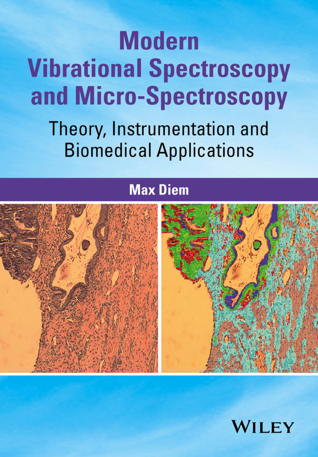 Modern Vibrational Spectroscopy and Micro-Spectroscopy Theory, Instrumentation and Biomedical Applications 1st Edition